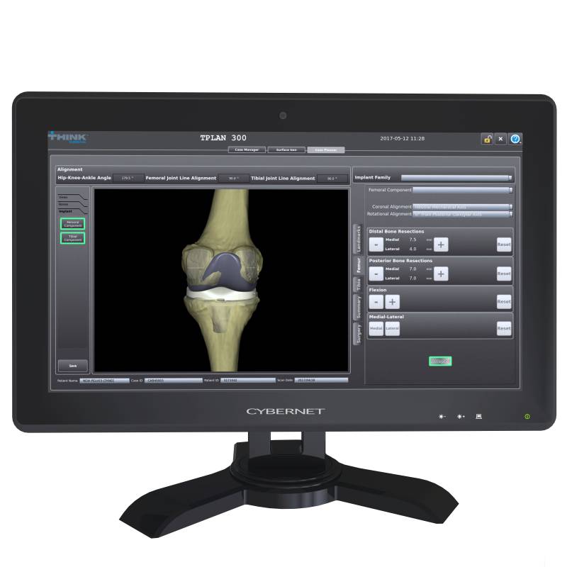 Curexo一家提供獨特產品和醫療解決方案的醫療機器人公司